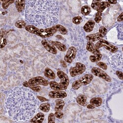 ATP6V1B1 Antibody, Novus Biologicals 25 &mu;L, Unlabeled:Antibodies, Polyclonal