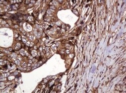 ATP6V1B2 Antibody (OTI1E11), Novus Biologicals 0.1mL; Unlabeled:Antibodies,