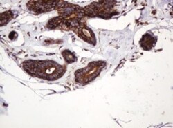 ATP6V1B2 Antibody (OTI1E11), Novus Biologicals 0.1mL; Unlabeled:Antibodies,