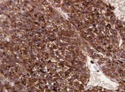 ATP6V1B2 Antibody (OTI1E11), Novus Biologicals 0.1mL; Unlabeled:Antibodies,