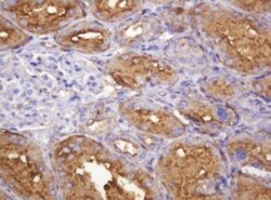 ATP6V1B2 Antibody (OTI1E11), Novus Biologicals 0.1mL; Unlabeled:Antibodies,
