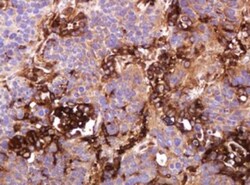 ATP6V1B2 Antibody (OTI1E11), Novus Biologicals 0.1mL; Unlabeled:Antibodies,