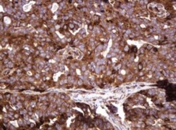 ATP6V1B2 Antibody (OTI1E11), Novus Biologicals 0.1mL; Unlabeled:Antibodies,