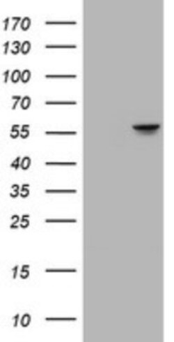 ATP6V1B2 Antibody (OTI1E11), Novus Biologicals 0.1mL; Unlabeled:Antibodies,