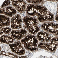 ATP6V1B2 Antibody, Novus Biologicals 0.1 mL | Buy Online | Novus Biologicals | Fisher Scientific