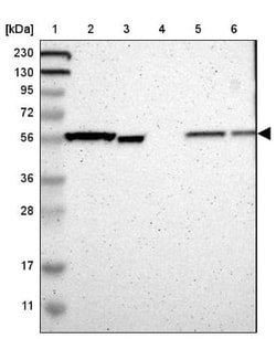 ATP6V1B2 Antibody, Novus Biologicals 0.1 mL | Buy Online | Novus Biologicals | Fisher Scientific