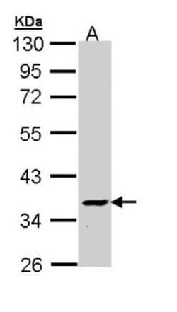 ATP6V1C2 Antibody, Novus Biologicals 0.1mg; Unlabeled:Antibodies, Polyclonal