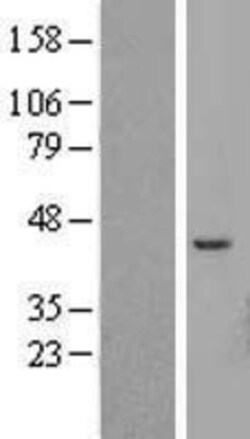 Novus Biologicals™ ATP6V1C2 Overexpression Lysate