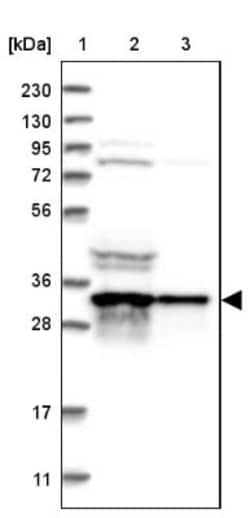 ATP6V1D Antibody, Novus Biologicals 25 &mu;L; Unlabeled:Antibodies, Polyclonal