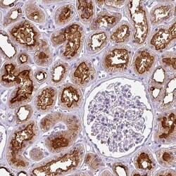 ATP6V1D Antibody, Novus Biologicals 25 &mu;L; Unlabeled:Antibodies, Polyclonal