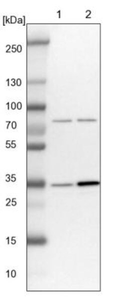 ATP6V1D Antibody, Novus Biologicals 25 &mu;L; Unlabeled:Antibodies, Polyclonal