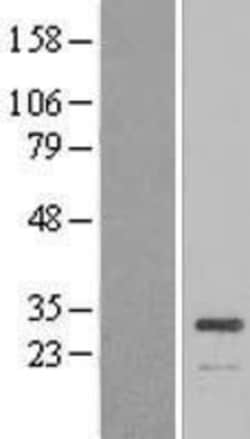 Novus Biologicals&trade;&nbsp;ATP6V1E1 Overexpression Lysate