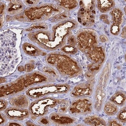ATP6V1E1 Antibody, Novus Biologicals 0.1mL; Unlabeled:Antibodies, Polyclonal