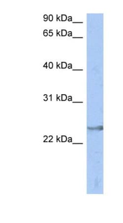 ATP6V1E2 Antibody, Novus Biologicals 20&mu;L; Unlabeled:Antibodies, Polyclonal