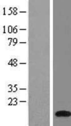Novus Biologicals™ ATP6V1G1 Overexpression Lysate