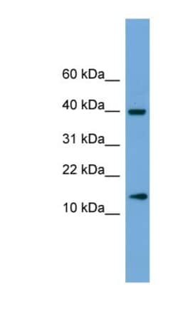 ATP6V1G2 Antibody, Novus Biologicals:Antibodies:Primary Antibodies