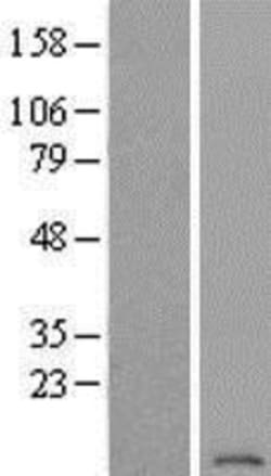 Novus Biologicals&trade;&nbsp;ATP6V1G2 Overexpression Lysate