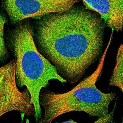 ATP6V1G3 Antibody, Novus Biologicals:Antibodies:Primary Antibodies