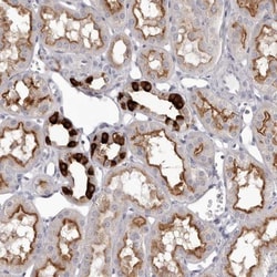 ATP6V1G3 Antibody, Novus Biologicals:Antibodies:Primary Antibodies