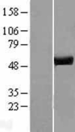 Novus Biologicals ATP6V1H Overexpression Lysate 0.1 mg | Buy Online | Novus Biologicals&trade; | Fisher Scientific
