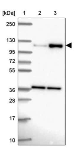 ATP8A1 Antibody, Novus Biologicals 0.1mL; Unlabeled:Antibodies, Polyclonal
