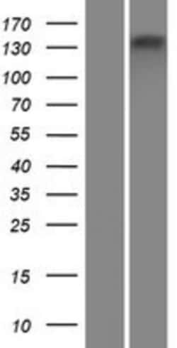 Novus Biologicals™ ATP8B4 Overexpression Lysate
