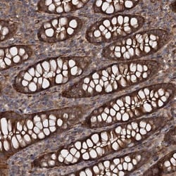 ATP8B4 Antibody, Novus Biologicals 0.1mL; Unlabeled:Antibodies, Polyclonal