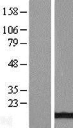 Novus Biologicals™ ATPase Inhibitory Factor 1 Overexpression Lysate