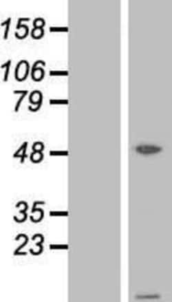 Novus Biologicals™ ATPase Inhibitory Factor 1 Overexpression Lysate