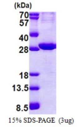 Novus Biologicals&trade;&nbsp;Recombinant Human ATPase Na+/K+ beta 2 His Protein
