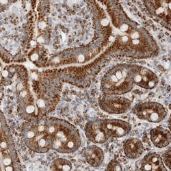 ATPase Inhibitory Factor 1 Antibody, Novus Biologicals 0.1mL; Unlabeled:Antibodies,