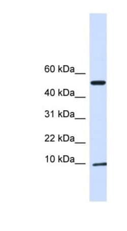 ATPase Inhibitory Factor 1 Antibody, Novus Biologicals 0.05mg; Unlabeled:Antibodies,