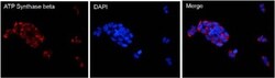 ATPB Antibody (4.3E8.D10), Novus Biologicals 0.1mg; Unlabeled:Antibodies,