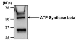 ATPB Antibody (4.3E8.D10), Novus Biologicals 0.1mg; Unlabeled:Antibodies,