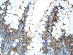 ATPB Antibody, Novus Biologicals 0.1mg; Unlabeled:Antibodies, Polyclonal