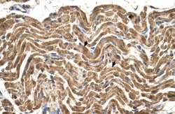ATPB Antibody, Novus Biologicals 0.1mg; Unlabeled:Antibodies, Polyclonal
