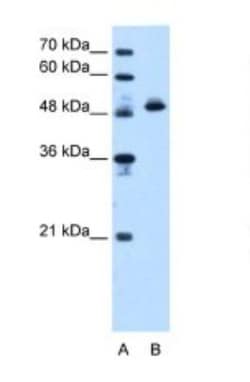 ATPB Antibody, Novus Biologicals 0.1mg; Unlabeled:Antibodies, Polyclonal
