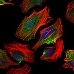 ATP Citrate Lyase Antibody (5F8D11) - BSA Free, Novus Biologicals 0.1mL;