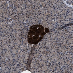 ATP Citrate Lyase Antibody, Novus Biologicals 0.1mL; Unlabeled:Antibodies,