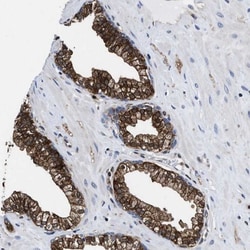 ATP Citrate Lyase Antibody, Novus Biologicals 0.1mL; Unlabeled:Anticuerpos