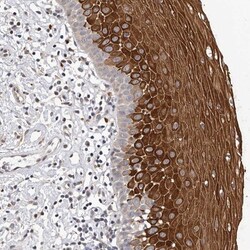 ATP Citrate Lyase Antibody, Novus Biologicals:Antibodies:Primary Antibodies