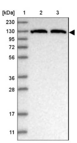 ATP Citrate Lyase Antibody, Novus Biologicals 0.1mL; Unlabeled:Antibodies,