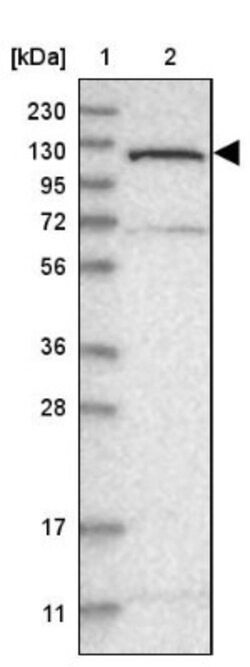 ATP Citrate Lyase Antibody, Novus Biologicals 0.1mL; Unlabeled:Antibodies,
