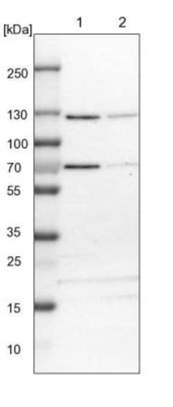 ATP Citrate Lyase Antibody, Novus Biologicals 0.1mL; Unlabeled:Antibodies,