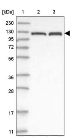 ATP Citrate Lyase Antibody, Novus Biologicals:Antibodies:Primary Antibodies