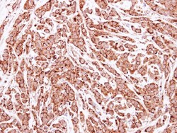 ATPG Antibody, Novus Biologicals 0.1mL; Unlabeled:Anticorps, Polyclonal