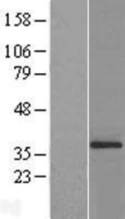 Novus Biologicals&trade;&nbsp;ATPG Overexpression Lysate