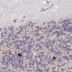 ATPGD1 Antibody, Novus Biologicals:Antibodies:Primary Antibodies