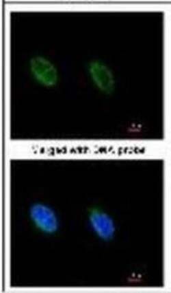 ATR Antibody (2B5), Novus Biologicals 0.1mL; Unlabeled:Antibodies, Monoclonal
