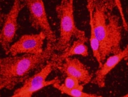 ATR Antibody, Novus Biologicals 0.1mg; Unlabeled:Antibodies, Polyclonal